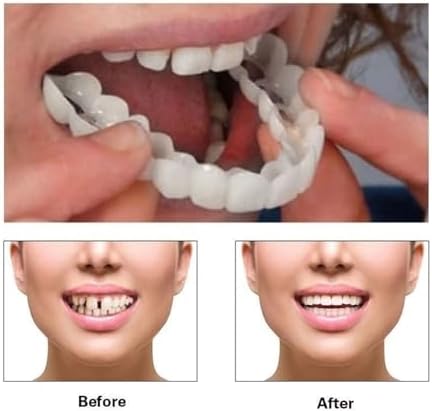 2 Pairs, Temporarily Adjustable for Men and Women, Regain Confidence Smile(Red)